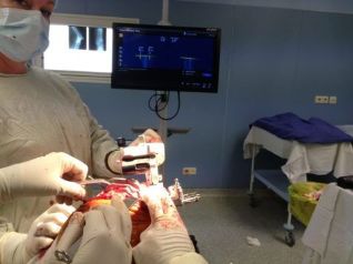 Surgical treatment of gonarthrosis